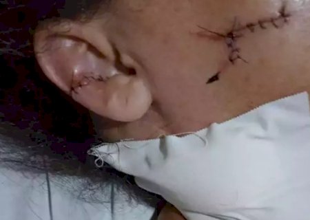 “Foi horroroso, desesperador”, diz motorista de aplicativo esfaqueada 15 vezes