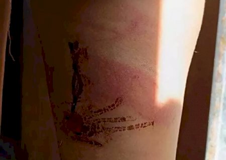 Pai espancava filha com mangueira e torturou esposa com arame quente