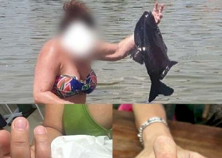 Em 3 meses, 11 turistas foram mutilados em ataques de peixes em atrativo fechado