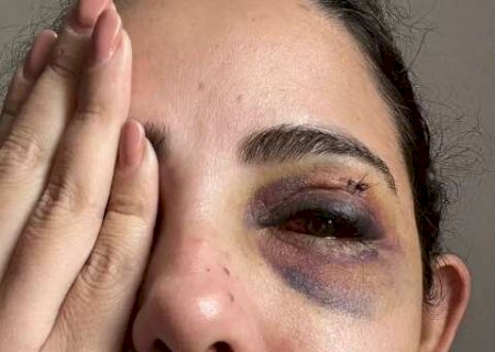 &ldquo;Quis acabar comigo&rdquo;: mulher denuncia ex por espancamento, estupro e c&aacute;rcere