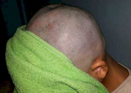 Mulher é agredida e tem cabelos cortados com faca pelo marido em fazenda de MS