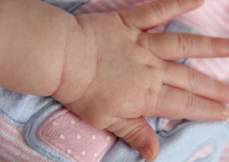 Bebê estuprado e agredido por padrasto morre na Santa Casa de Campo Grande