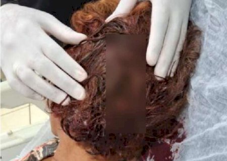 "Para servir de exemplo": traficantes torturam mulher por d&iacute;vida de R$ 50>