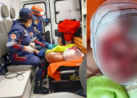 Idoso é atacado por cachorro e sofre múltiplas lacerações no rosto em Aquidauana>