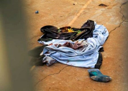 Ex-militar baleado na cabe&ccedil;a foi confundido com o irm&atilde;o em guerra de fac&ccedil;&otilde;es>